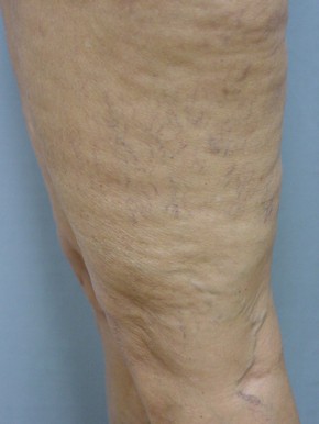Veins