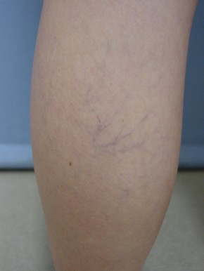 Veins