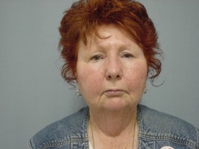 Chin Augmentation