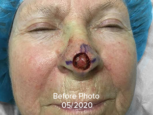 Face Reconstruction