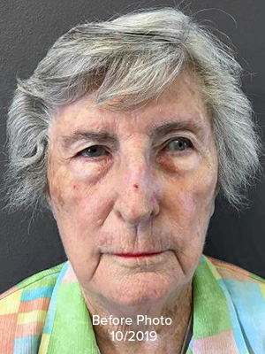 Face Reconstruction