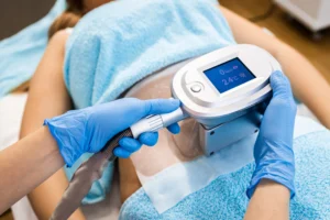 CoolSculpting treatment