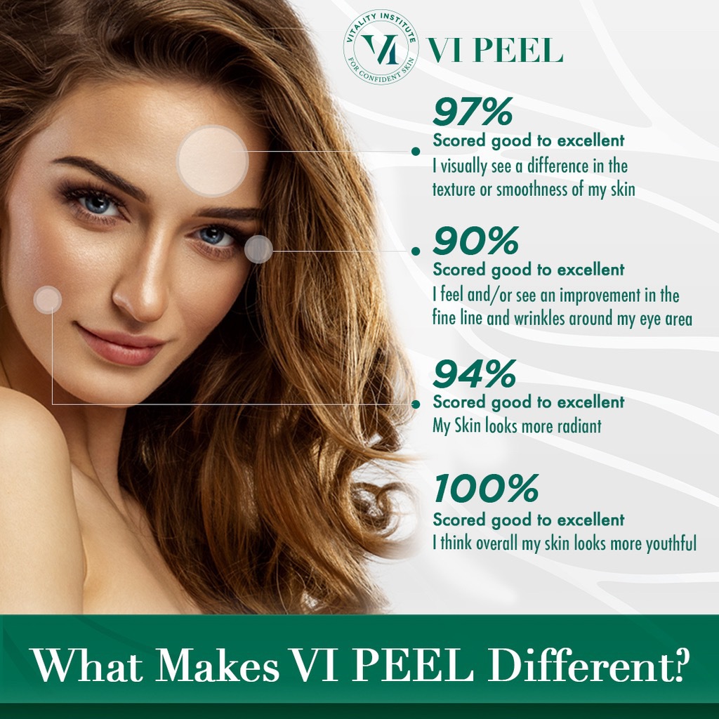 What makes VI Peel Different